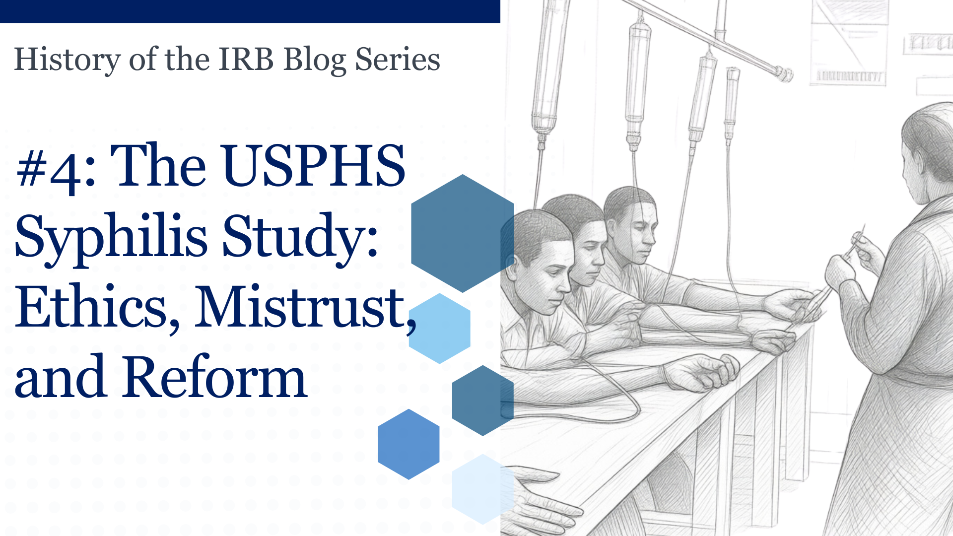 History of the IRB #4 Hero Image